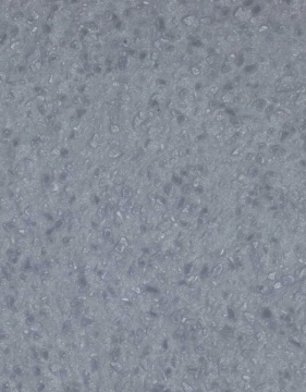 Noyeks - Hanex - Solid Surfaces